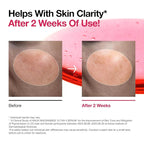 Anua 10% Niacinamide+ 4% Tranexamic Acid Serum