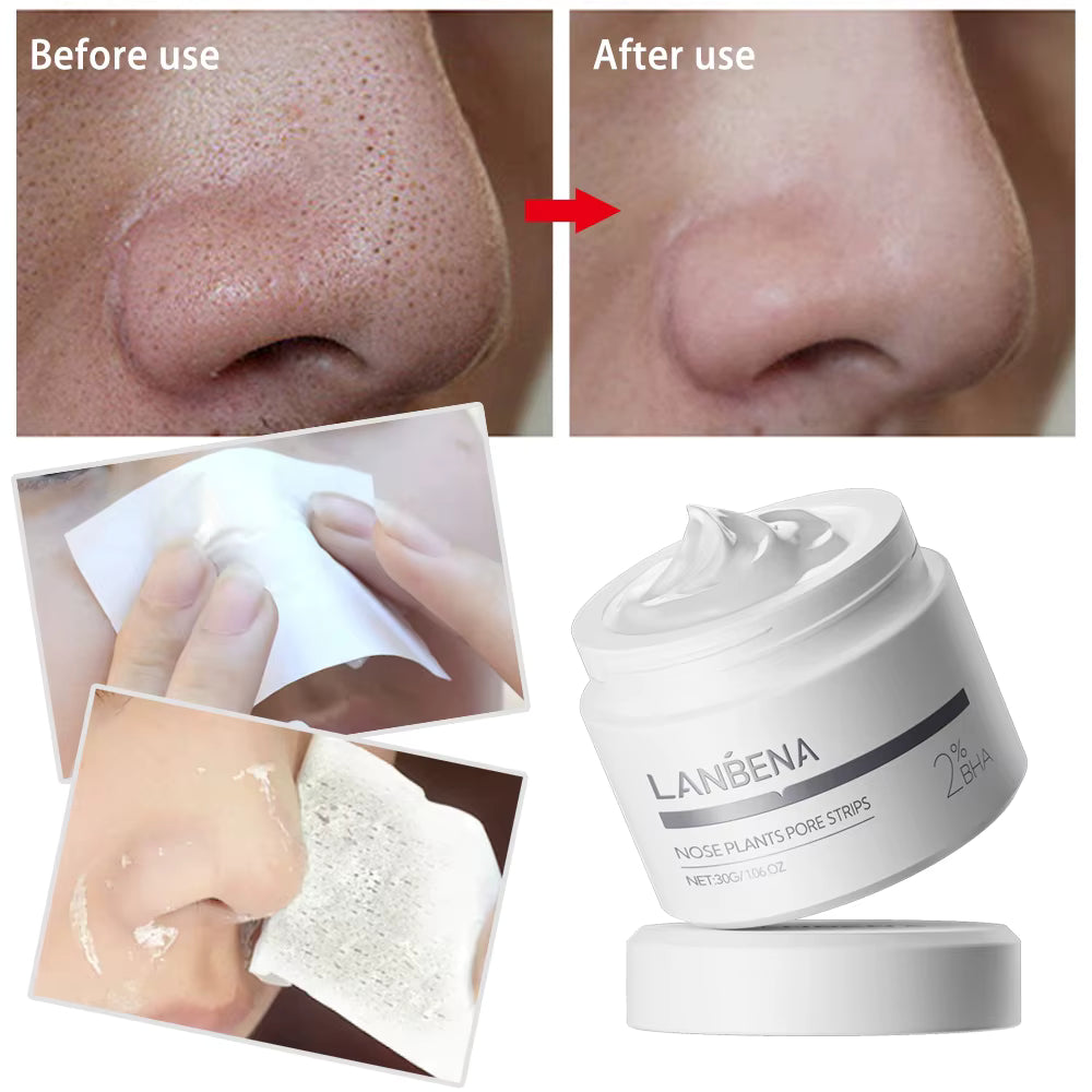 LANBENA Plastic Blackhead Remover