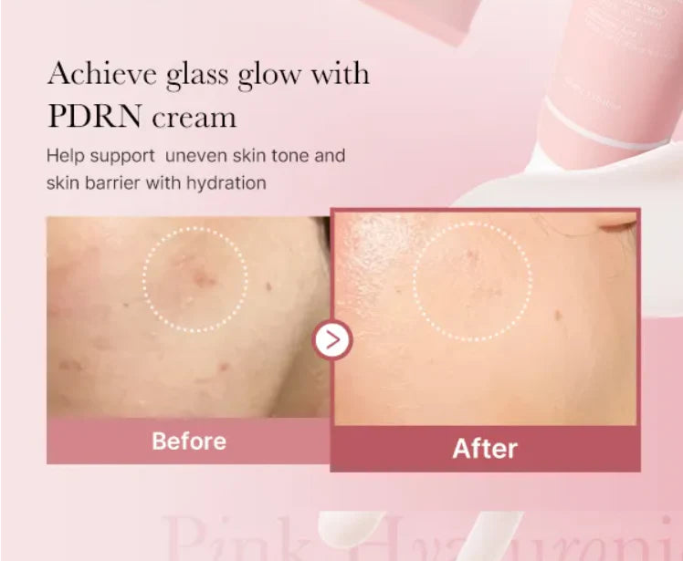 Medicube PDRN Pink Hyaluronic